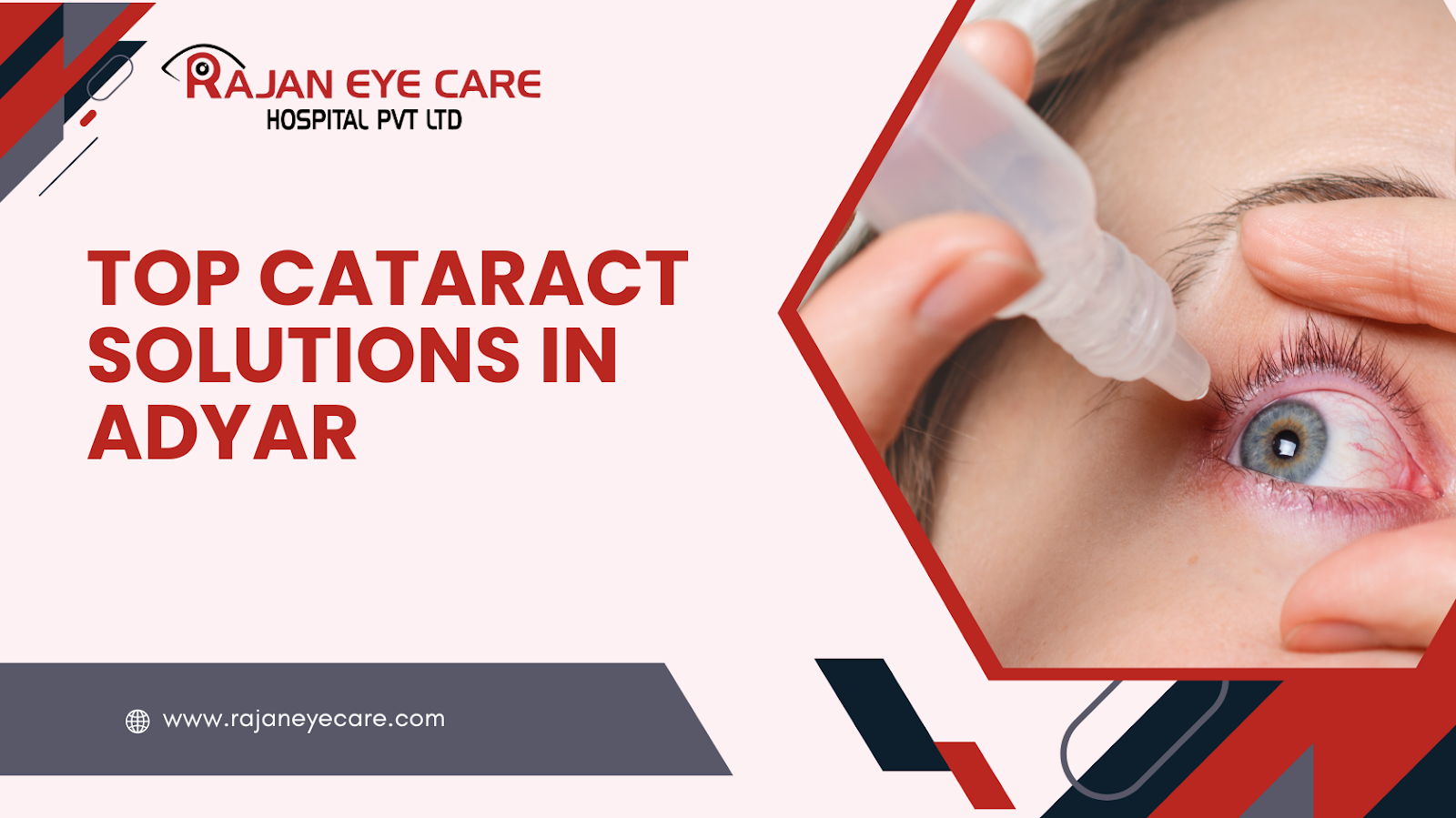 Advanced cataract treatment options available at leading eye hospitals in Adyar
